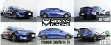 Megan Racing® (16-20) Hyundai Elantra AD Lowering Springs