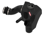 Takeda® (14-20) MDX/Honda Momentum Cold Air Intake System