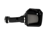 Takeda® (17-20) Civic Si Stage-2 Air Intake System