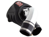 Takeda® (12-15) ILX/Civic Si Momentum Cold Air Intake System