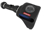 Takeda® (17-20) Honda Civic Si 1.5L Momentum Cold Air Intake System