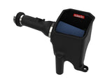 Takeda® (17-20) Civic Si Stage-2 Air Intake System