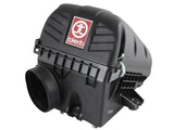 Takeda® (12-15) ILX/Civic Stage-2 Cold Air Intake System
