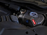 Takeda® (14-20) MDX/Honda Momentum Cold Air Intake System
