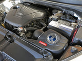 Takeda® (12-17) Hyundai Veloster Momentum Cold Air Intake System (Naturally Asiprated)