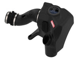 Takeda® (14-20) MDX/Honda Momentum Cold Air Intake System