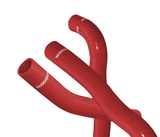 MISHIMOTO MMHOSE-EVO-10