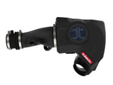 Takeda® (14-20) MDX/Honda Momentum Cold Air Intake System