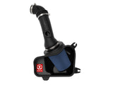 Takeda® (16-21) Civic Stage-2 Cold Air Intake System