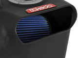 Takeda® (17-20) Honda Civic Si 1.5L Momentum Cold Air Intake System
