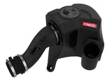 Takeda® (14-20) MDX/Honda Momentum Cold Air Intake System